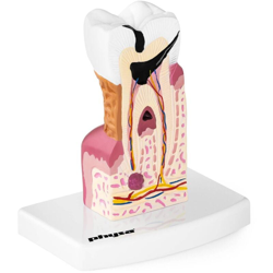 Modello Anatomico Dente Molare Malato 3D Studi Dentistici Odontoiatria Plastica - PHYSA características